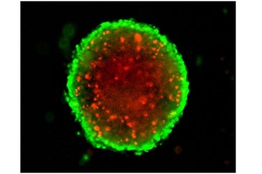 3D Spheroid Assays For Cancer Drug Screening