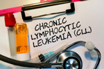 Understanding CLL And SLL Treatment Evolution Acute Chronic Lymphocytic Leukemia CLL-GettyImages-1341097962
