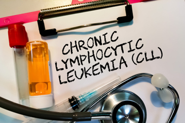 Acute Chronic Lymphocytic Leukemia CLL-GettyImages-1341097962 Acute Chronic Lymphocytic Leukemia CLL-GettyImages-1341097962