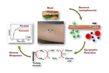 tattoo_diabetesmonitoring