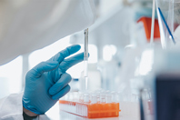 The Growing Role Of MSCs In Regenerative Medicine GettyImages-1347856181 assay, pipette