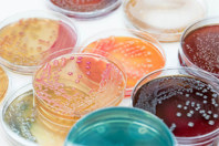 Optimal Microbial Sampling Criteria GettyImages-614242432-petri-dish-micro-organisms-bacteria