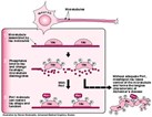 New Enzyme Tied to Tangles in Alzheimer's Disease New Enzyme Tied to Tangles in Alzheimer's Disease