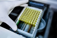 Multiparameter Characterization Of CAR-T Cells GettyImages-1425761734-assay-researcher-hand-gloves-analysis