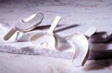 Posterior and Anterior Impression Trays Posterior and Anterior Impression Trays