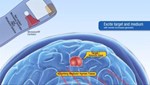 “Tricorder-Like” Technology Could Provide Contact-Free Ultrasound ultrasound