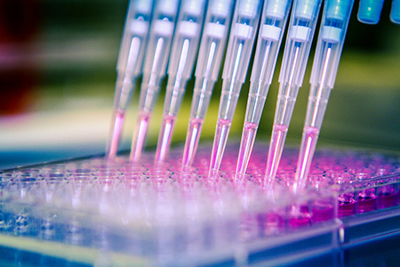 Analysis Of Cancer Spheroids Through High-Throughput Screening Assays