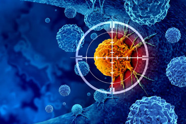 Cancer detection-GettyImages-1477214805