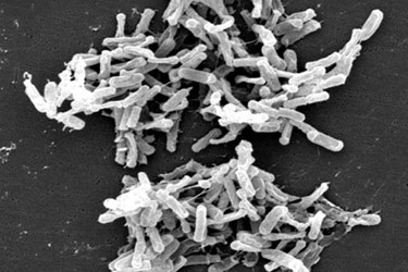 Clostridium Clostridium